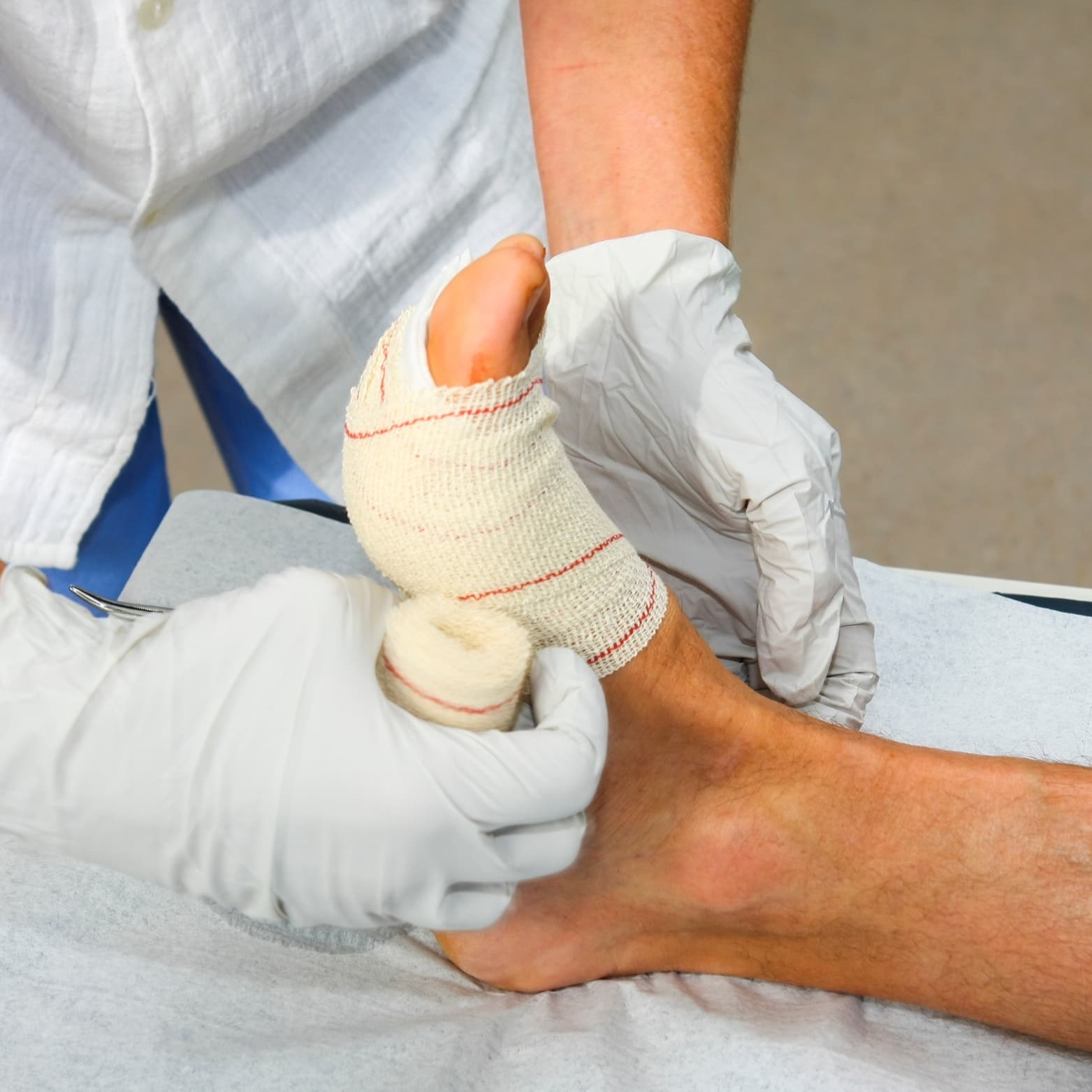 A clinician in gloves dressing a wound on a patient's foot
